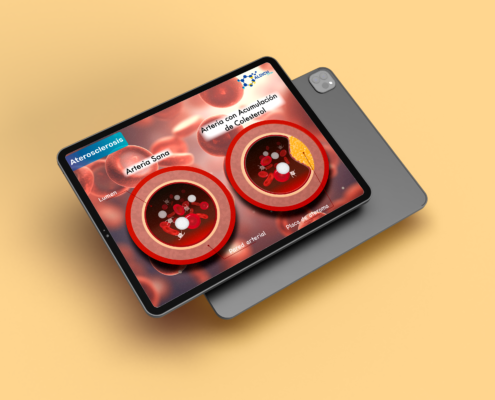 aterosclerosis-mockup-portfolio-495x400